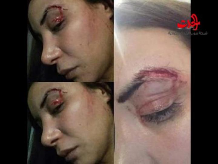 بالصور.. هذه الممثلة اغتصبها والدها منذ طفولتها.. من هي؟