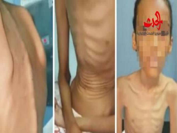 صور صادمة.. أم سعودية تحبس أطفالها على السطح وتمنع عنهم الطعام !