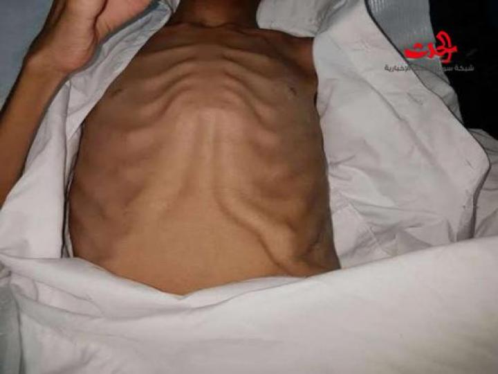 صور صادمة.. أم سعودية تحبس أطفالها على السطح وتمنع عنهم الطعام !