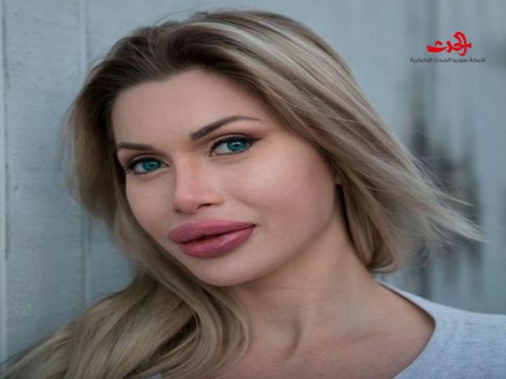 لن تتخيّلوا كيف أصبحت بعد 18 عملية تجميل صور!