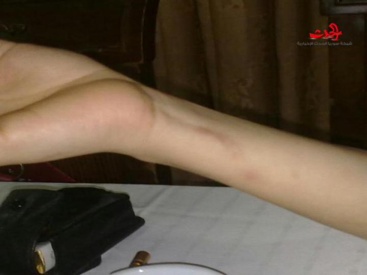 طالب الطب دفع بها إلى الانتحار.. والصديقة الخائنة تظهر أحقاد خفية