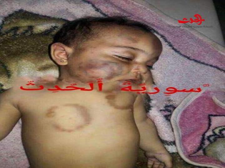 جريمة وحشية  تهز جرمانا ...&quot;الأب&quot; يعض طفلته حتى الموت  