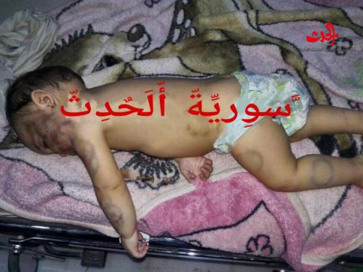 جريمة وحشية  تهز جرمانا ...&quot;الأب&quot; يعض طفلته حتى الموت  