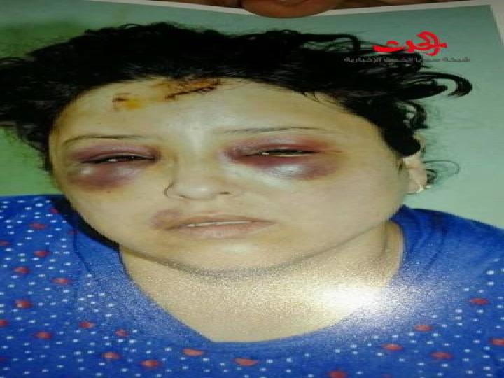 رفضت طلب 3 أشقاء فكان هذا جزاؤها...صور