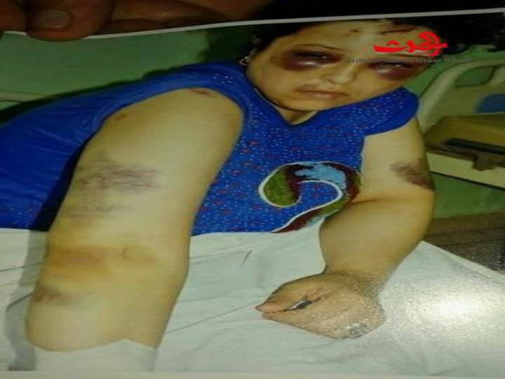 رفضت طلب 3 أشقاء فكان هذا جزاؤها...صور