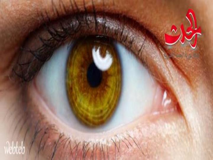 ألم العين متى يكون حالة طارئة تتطلب العلاج؟