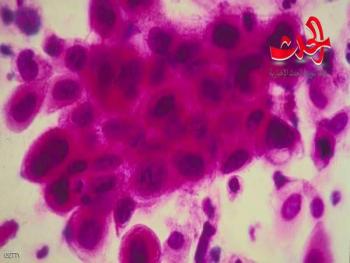 العلماء يكتشفون الخديعة الكبرى للخلايا السرطانية