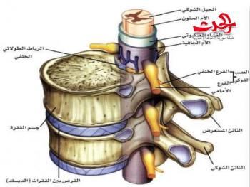 مرض عرق النسا.....وماهي اسبابه وعلاجه....وكيف تحمي نفسك منه  !!!