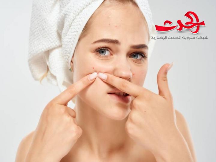 10 طرق لعلاج مشكلة حَب الشباب
