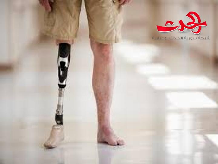 «جايبور» الهندية للأطراف الصناعية: مستمرون في التعاون رغم «العقوبات»