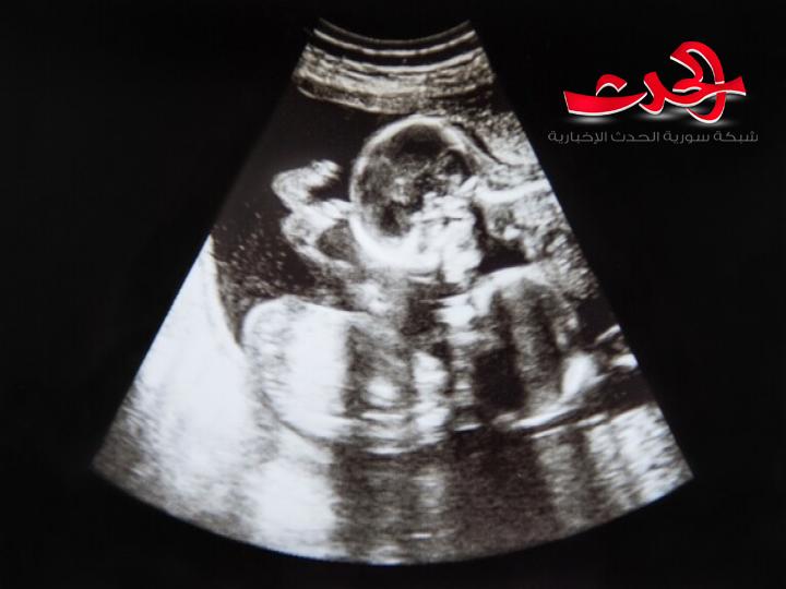 طفلة "تتلاشى" في الرحم بالموجات فوق الصوتية !