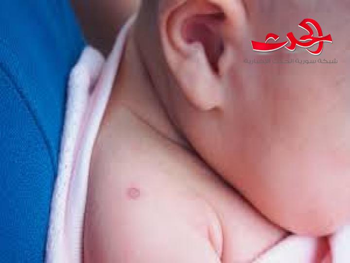 هل تلقيت هذا اللقاح في صغرك.. قد يحميك من كورونا