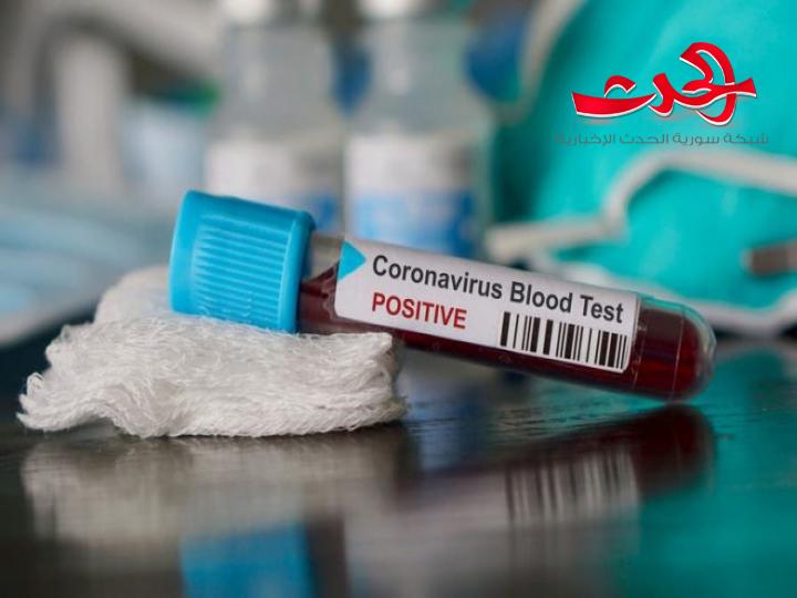 لا حالات اشتباه بكورونا في الرقة