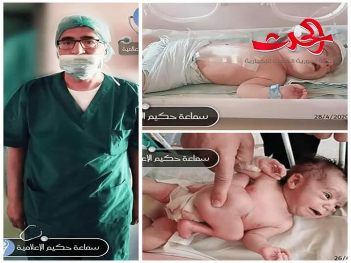مشفى الأطفال الجامعي بدمشق يجري عملية ناجحة لفصل توأم سيامي