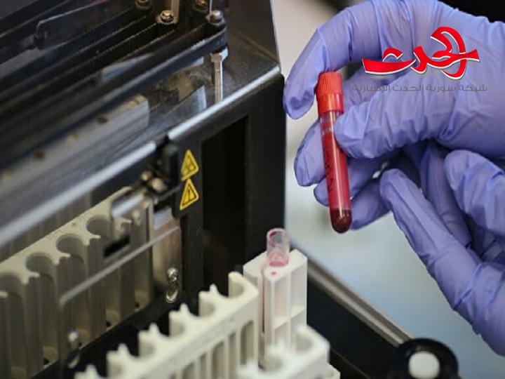 إلى جانب تحليل كورونا على المرضى إجراء هذا التحليل