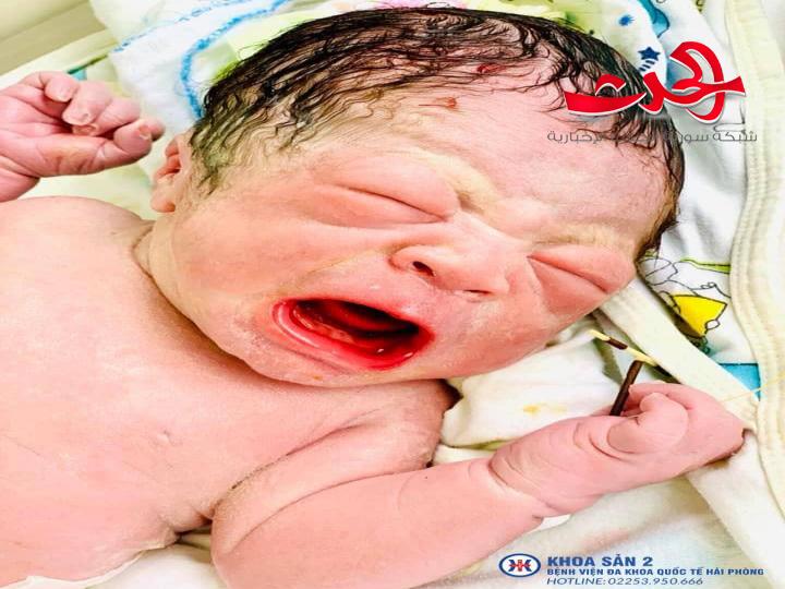 صور لمولود حديث الولادة بحمل وسيلة منع حمل أمه بين يديه