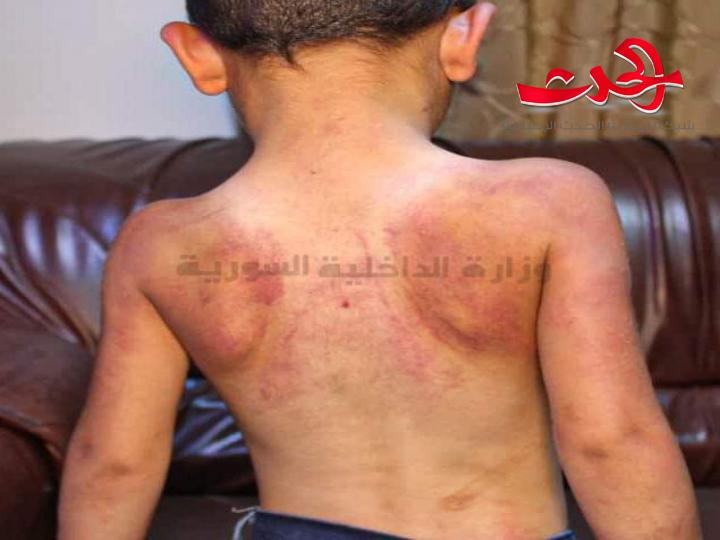 شرطة المزة الشرقية تلقي القبض على أم تعذب طفلها اشد انواع التعذيب