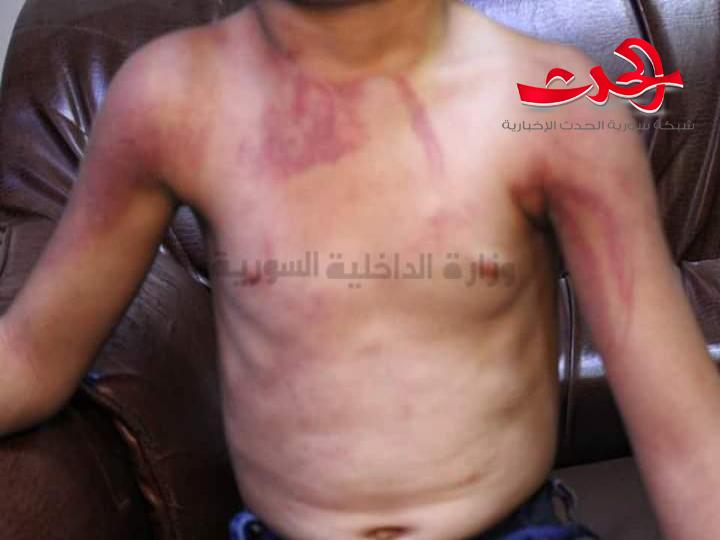 شرطة المزة الشرقية تلقي القبض على أم تعذب طفلها اشد انواع التعذيب
