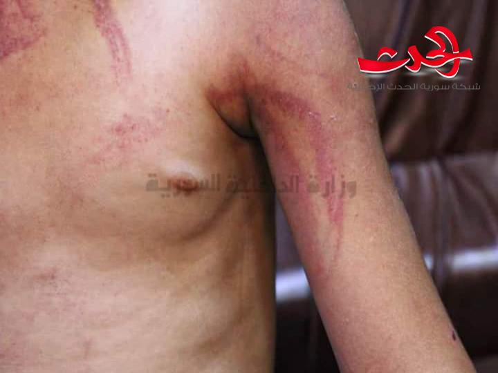 شرطة المزة الشرقية تلقي القبض على أم تعذب طفلها اشد انواع التعذيب