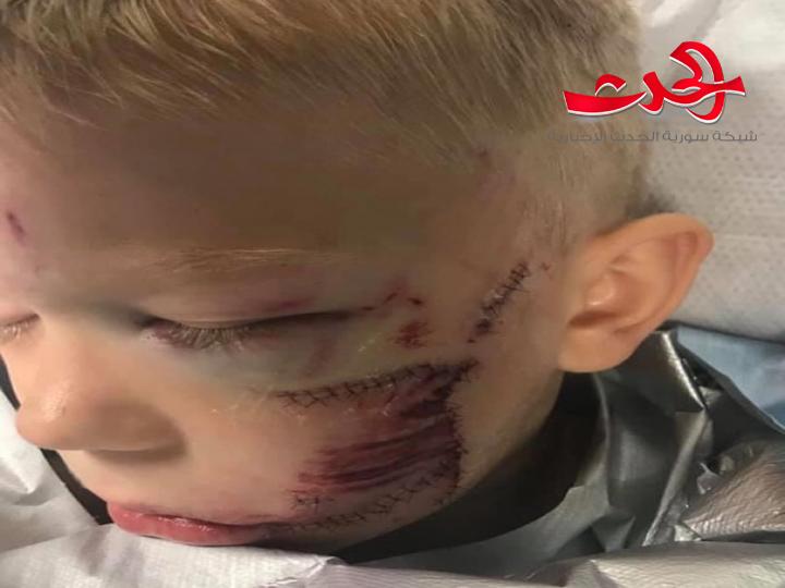 طفل يتصدى لكلب شرس دفاعا عن شقيقته
