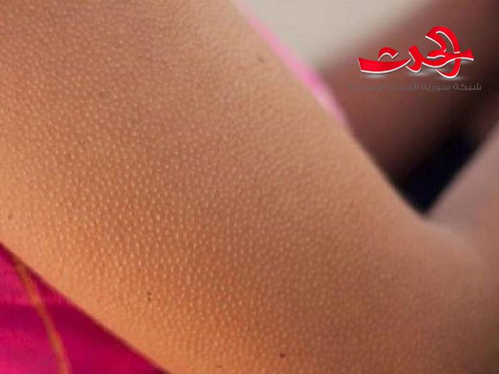 علماء: القشعريرة تجعل شعرك ينمو!