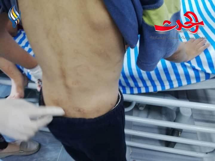 اطفال يتعرضون للضرب من زوجة ابيهم في جبلة.. والشرطة تلقي القبض عليعا