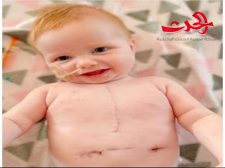 طفلة أمريكية بحاجة إلى ثلاثة قلوب لتبقى على قيد الحياة