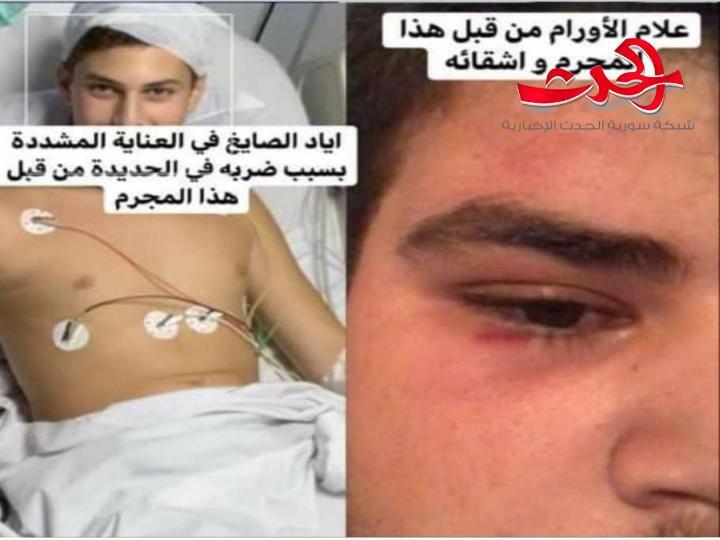 ما حقيقة " خناقة " الجاحظ  ... الموضع بيد القضاء