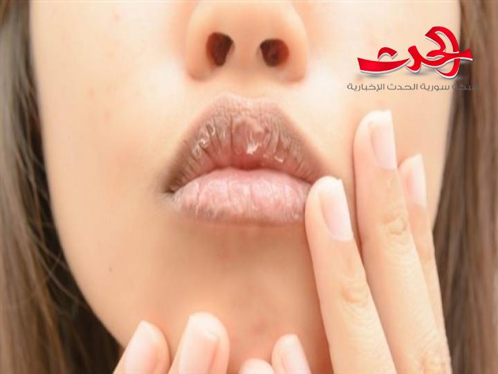 نصائح ذهبية للعناية بالشفاه في الشتاء 