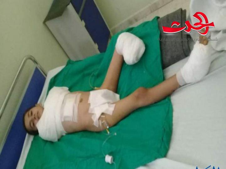 بتر ثلاثة اطراف للطفل يزن الذي صعقته الكهرباء فهل يتعظ المسؤولون؟