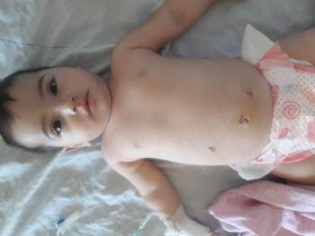مشفى الشرطة بحرستا يجري عملية نوعية لطفلة