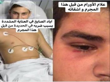 ما حقيقة " خناقة " الجاحظ  ... الموضع بيد القضاء