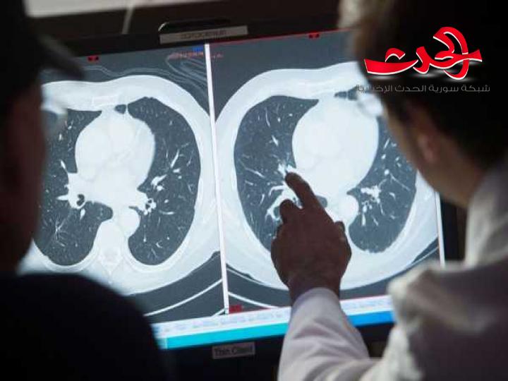 علماء : تكنولوجيا جديدة تهزم الأورام السرطانية