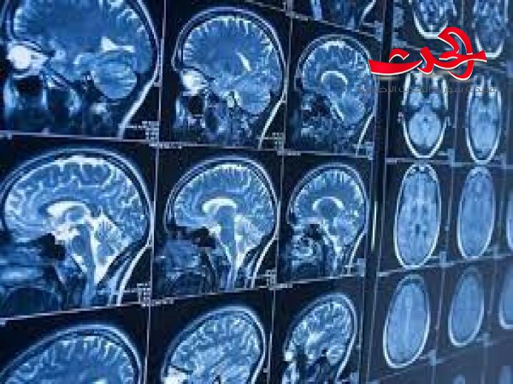  باحثون : اللياقة البدنية مفتاح علاج الخرف