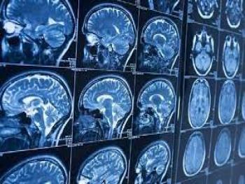  باحثون : اللياقة البدنية مفتاح علاج الخرف