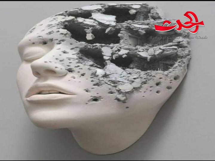 طفلة مشوهة/ بقلم الكاتبة بتول عبيدو